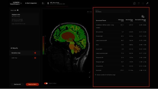 边缘AI癌症治疗相关