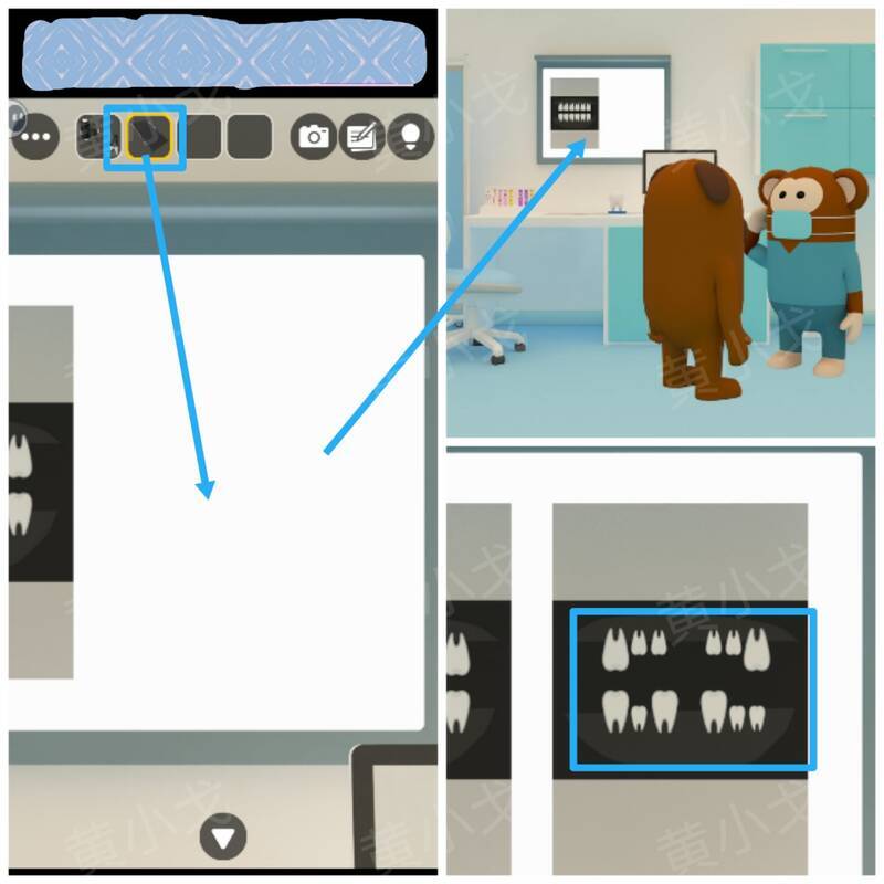 影像板上X光片线索画面