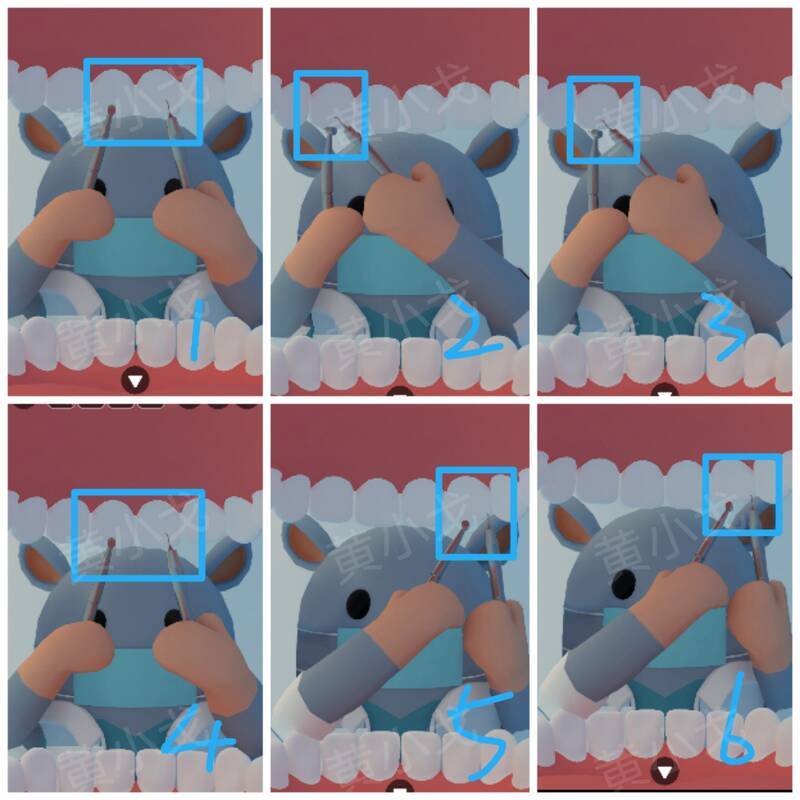 医生检查牙齿顺序画面