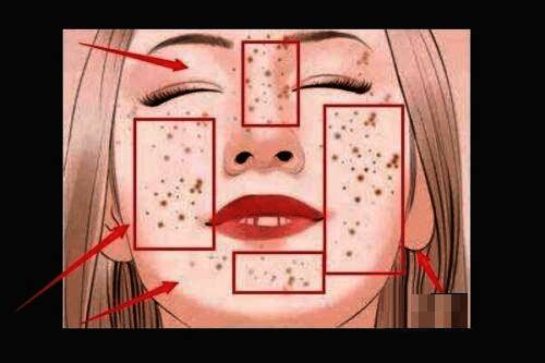 人物面部存在明显斑点的照片