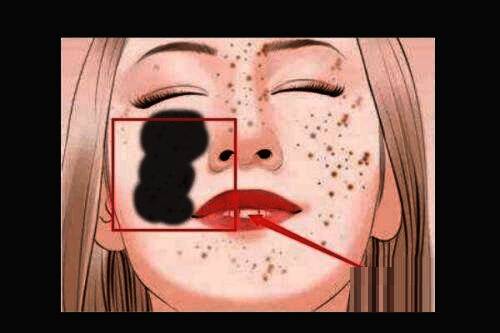 正在使用污点修复工具进行涂抹操作的示例画面