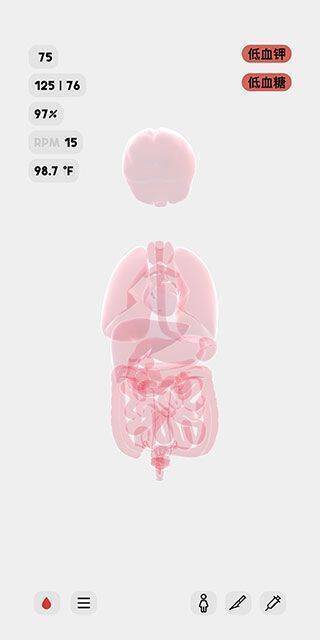 显示人体模型异常状态界面